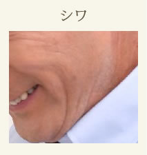 シワ